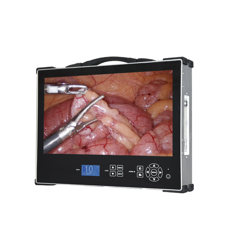 Sistema de imagem de c&acirc;mera endosc&oacute;pica integrada port&aacute;til HD 1080P de 21 polegadas para cirurgia otorrinolaringol&oacute;gica