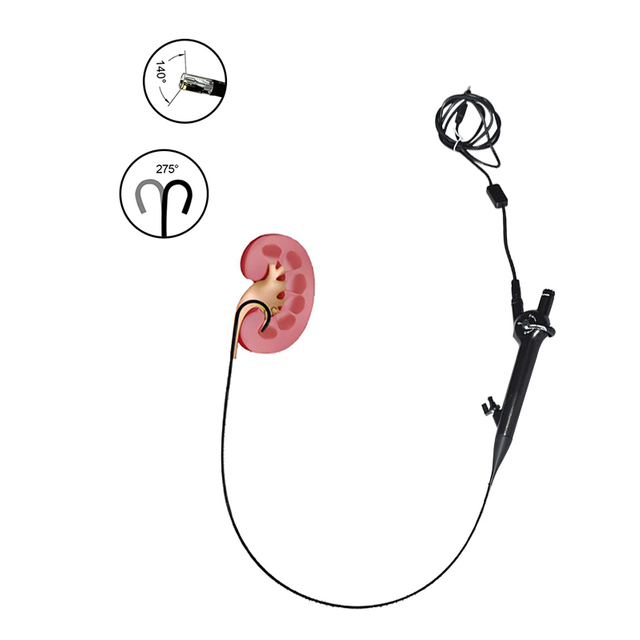 Ureterosc&oacute;pio de metal reutiliz&aacute;vel de urologia el&eacute;trica HD flex&iacute;vel