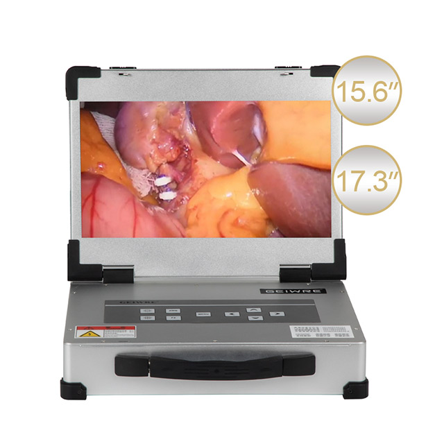 Портативная встроенная эндоскопическая камера HD-320 с разрешением 1080P — двойного назначения для ЛОР- и гинекологических процедур