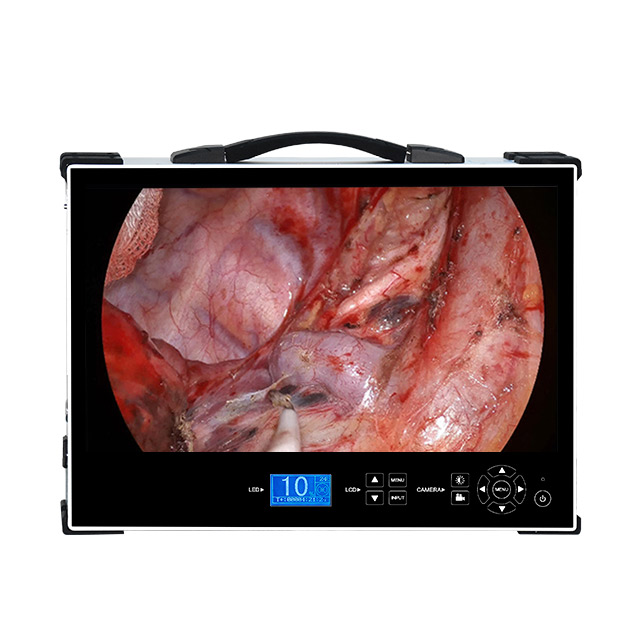 Портативная 21-дюймовая встроенная эндоскопическая камера, медицинская ЛОР/урология/лапароскопия/гистероскопия 