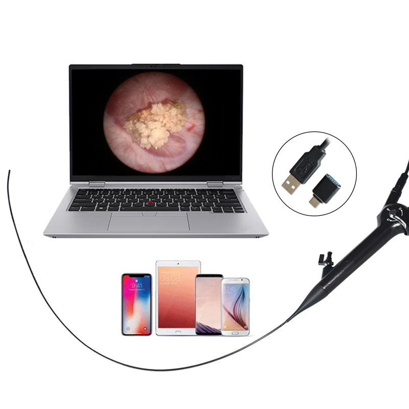 Wiederverwendbares flexibles Choledochoskop f&uuml;r minimalinvasive Chirurgie