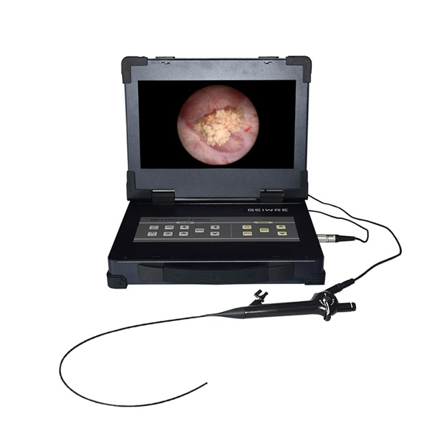 Chol&eacute;dochoscope flexible r&eacute;utilisable pour chirurgie mini-invasive