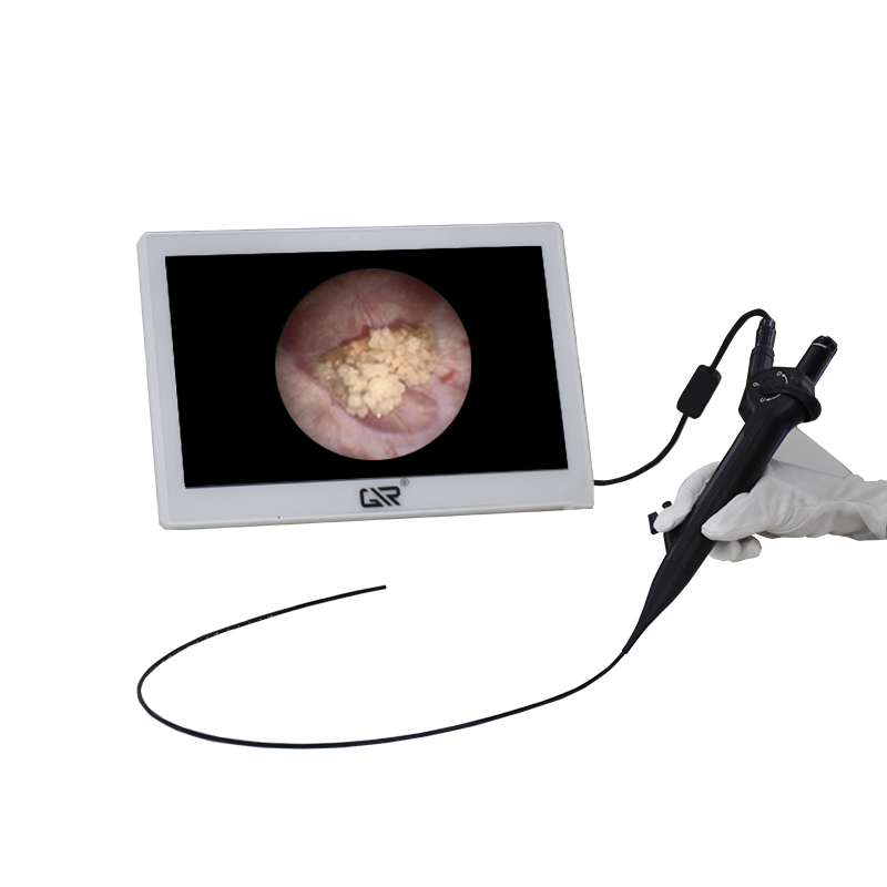 Wiederverwendbares flexibles Choledochoskop f&uuml;r minimalinvasive Chirurgie